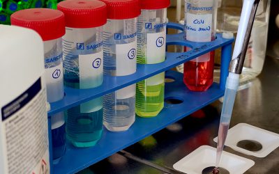 Wie lang Coronaviren auf Flächen überleben und wie man sie inaktiviert