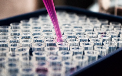 Der Antikörper-ELISA-Test