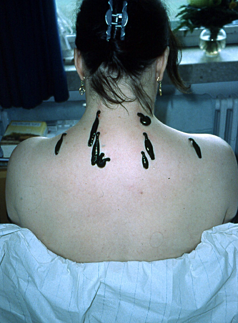 Erkrankungen des Bewegungsapparats: wie kann die stationäre Naturheilkunde helfen?